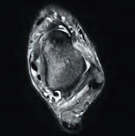 Manuel Eitel MRI 2016. május 31.